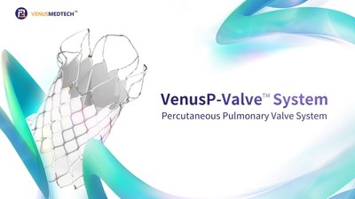 VenusP-Valve(TM)获欧盟CE MDR认证上市，国产瓣膜首登