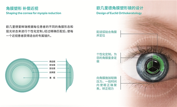 欧几里德OK镜小课堂：做好近视管理，深度定制很